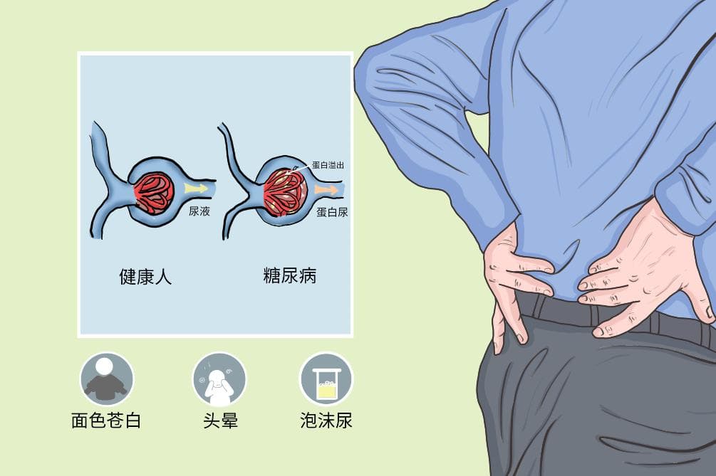 糖尿病肾病