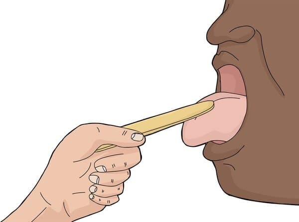 食物卡在鼻子和喉咙之间怎么办