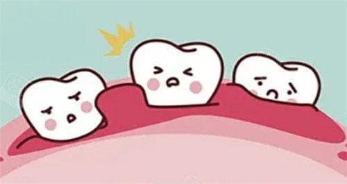 根尖囊肿治疗费用全解析：治疗选择与价格概览！不同治疗方式费用从几百到几千元不等！