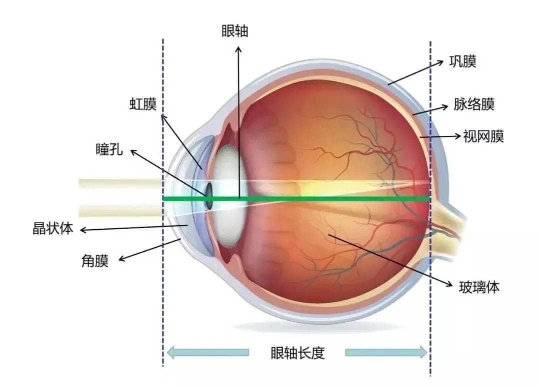 【近视防控】轴率比有什么用？