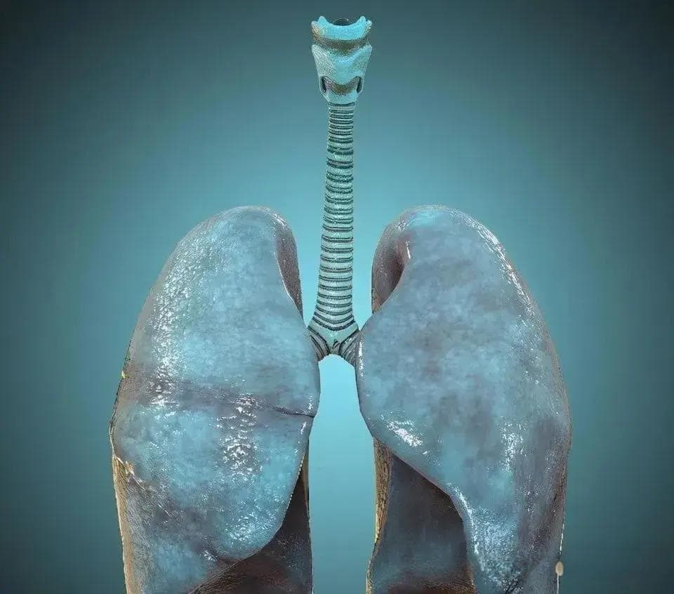 肺结节CT结果如何自我解读呢？