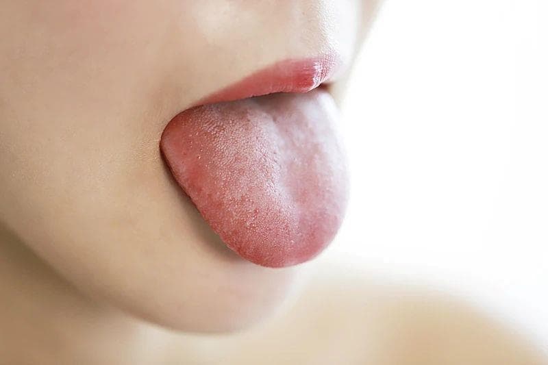 身体好不好看舌苔就知道？出现这3种颜色要注意，自查→