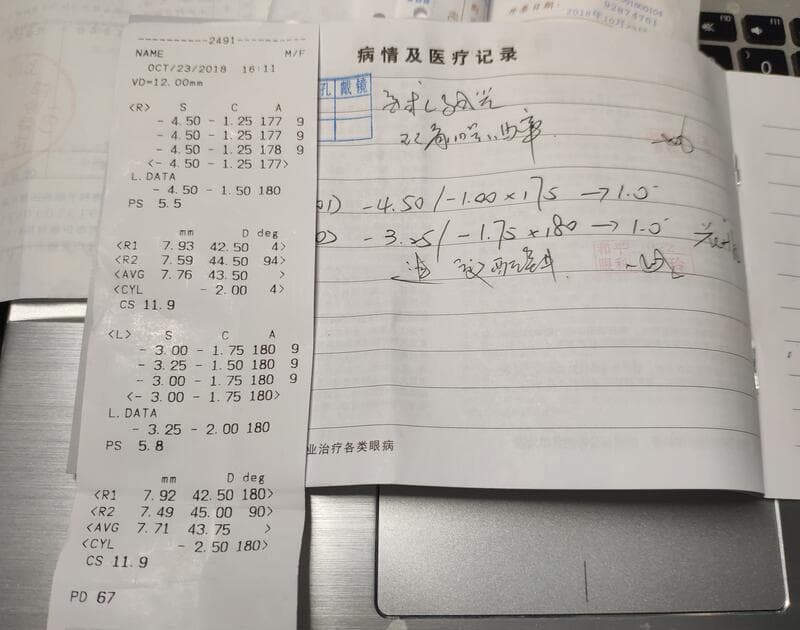 医院手写验光单（配镜处方）怎么看？最详尽解读帮你一分钟搞定！