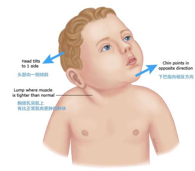 孩子的头睡扁了怎么办？医生妈妈教你“圆”回来