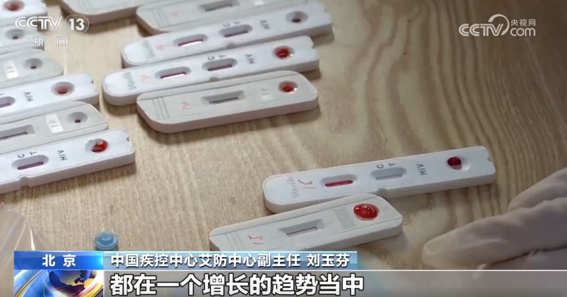 我国艾滋病整体疫情仍处于低流行水平 公众预防应该怎么做？一文了解！