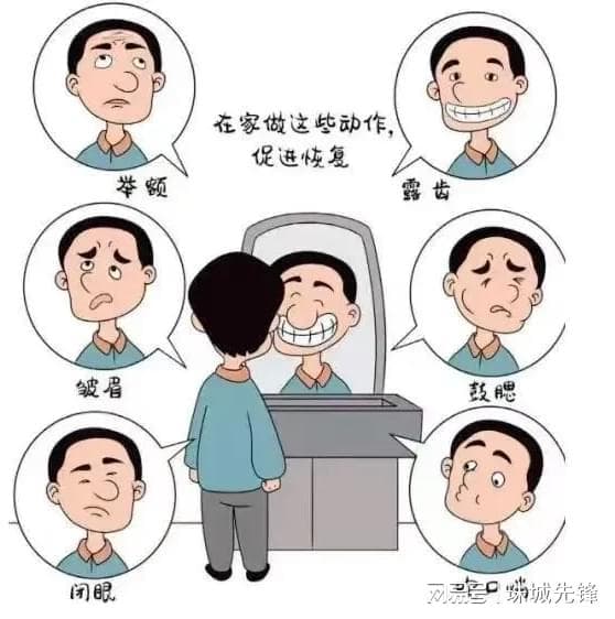 面瘫科普：症状、原因与治疗方法全解析