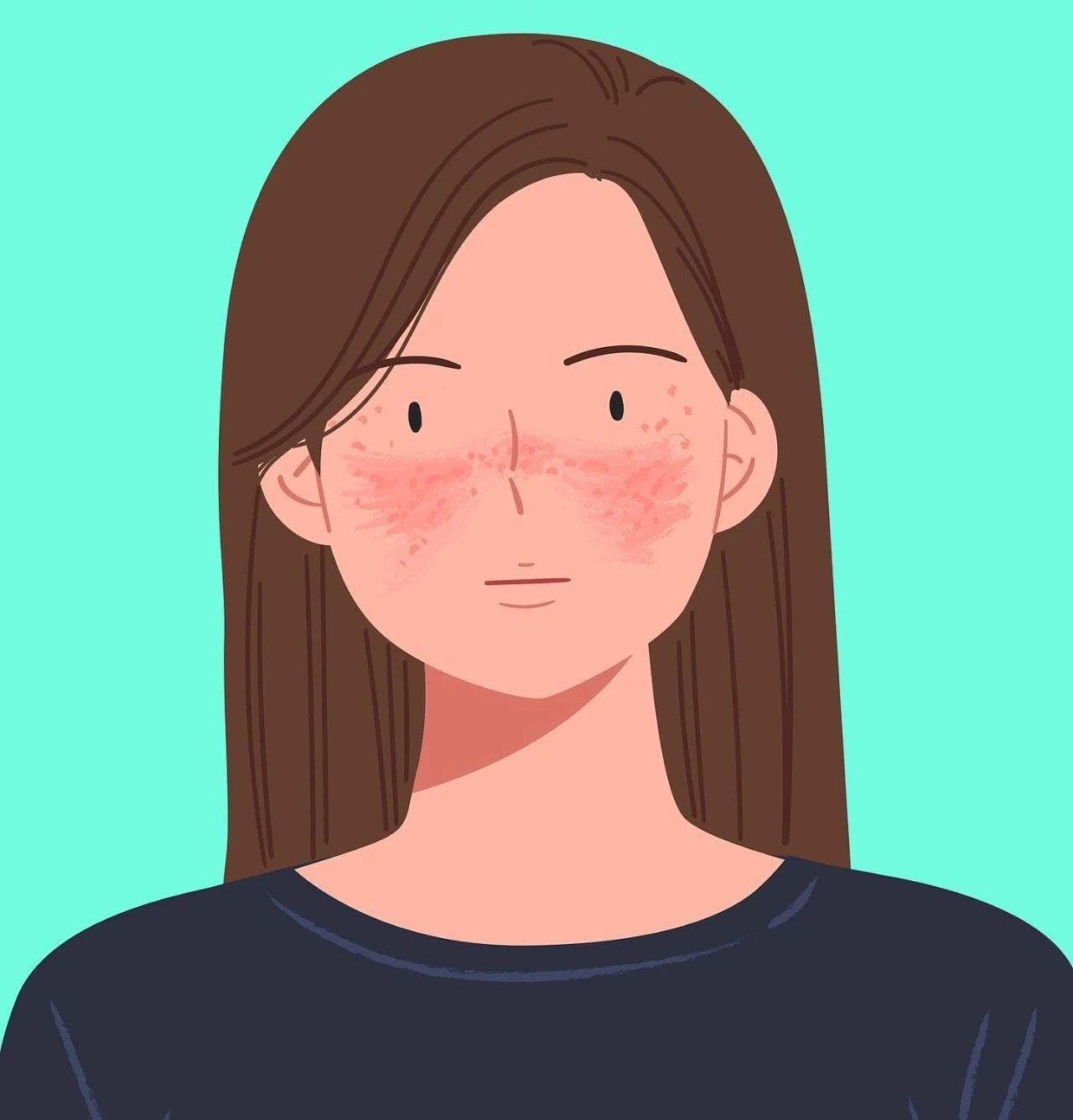 红斑狼疮是绝症吗？常规体检能否发现？一起了解→