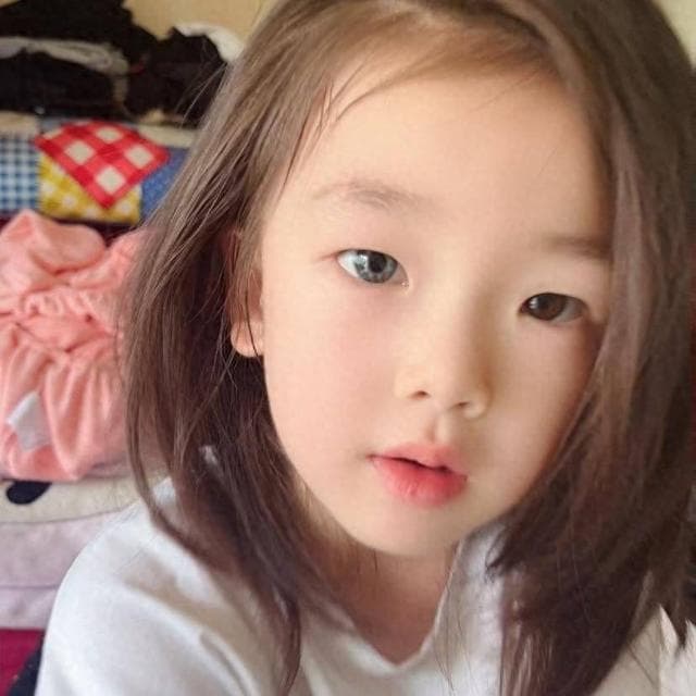 江西7岁女孩天生异瞳 眼睛一只蓝色一只棕色 医生：遗传基因导致 对视力没影响