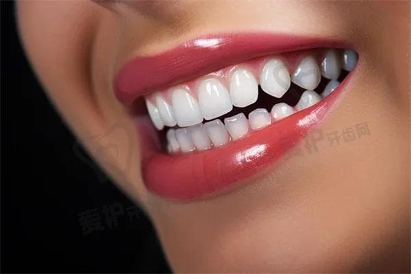拔牙后可以吃橘子吗？了解拔牙后的饮食注意事项与建议