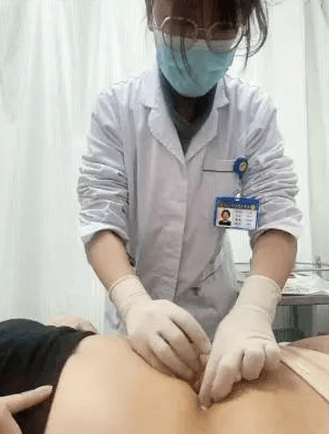 中医减肥新思路，穴位埋线受欢迎