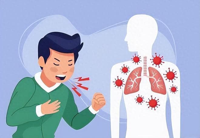 出现这些症状，可能是慢性支气管炎在作怪，远离4个发病因素