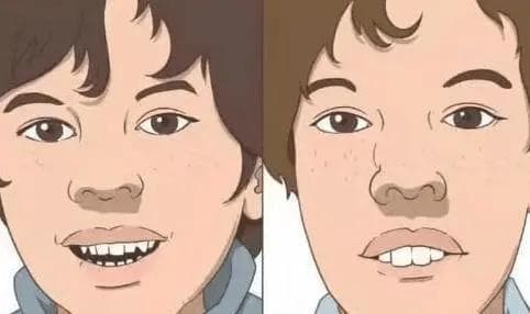 腺样体肥大的危害，家长赶快替孩子了解一下！