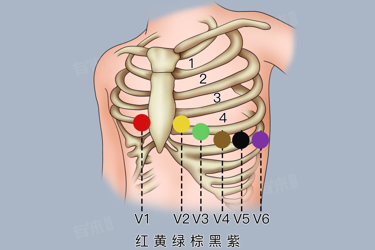 心电图5导联的口诀和颜色是什么