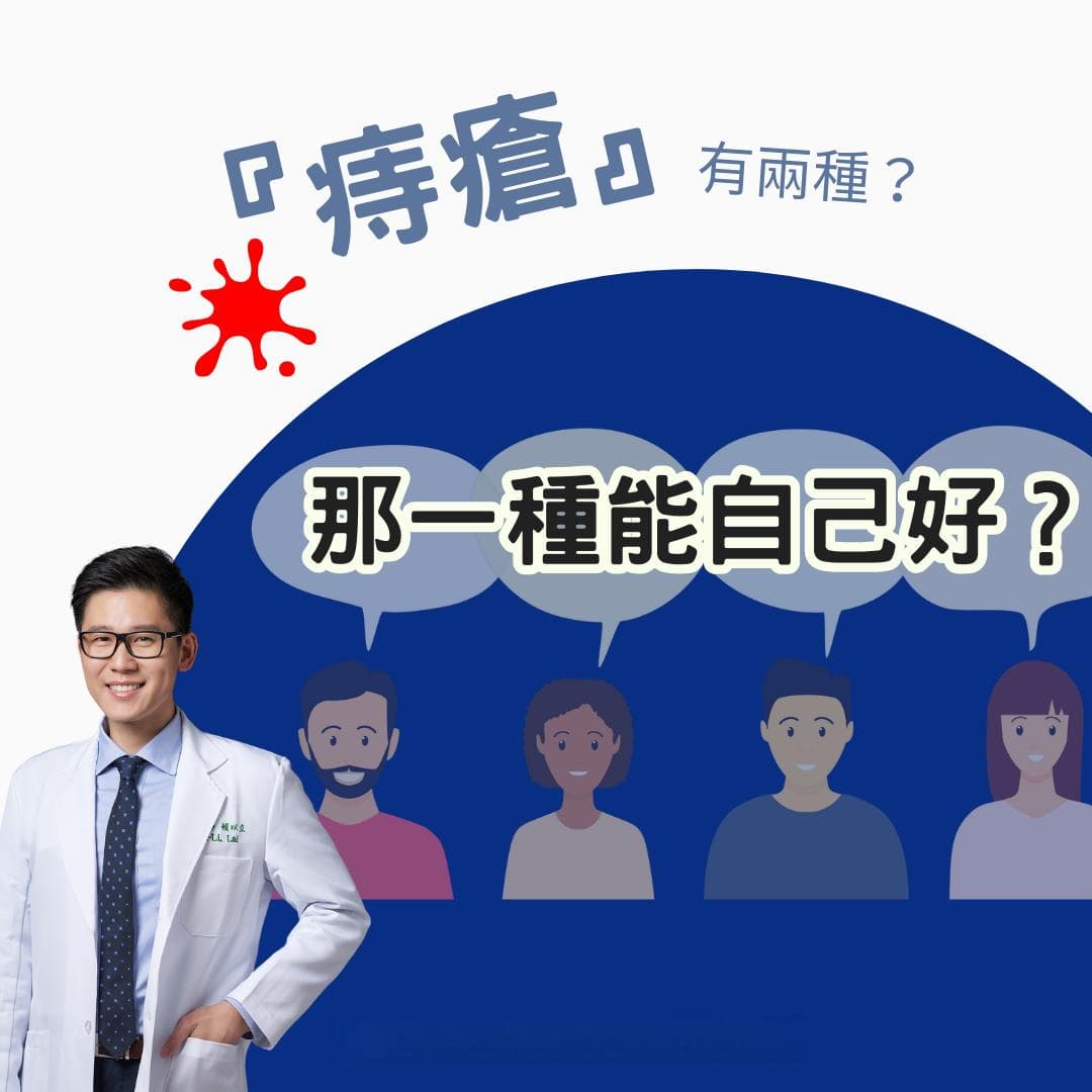 痔疮怎么治疗？四种微创痔疮手术完整解析