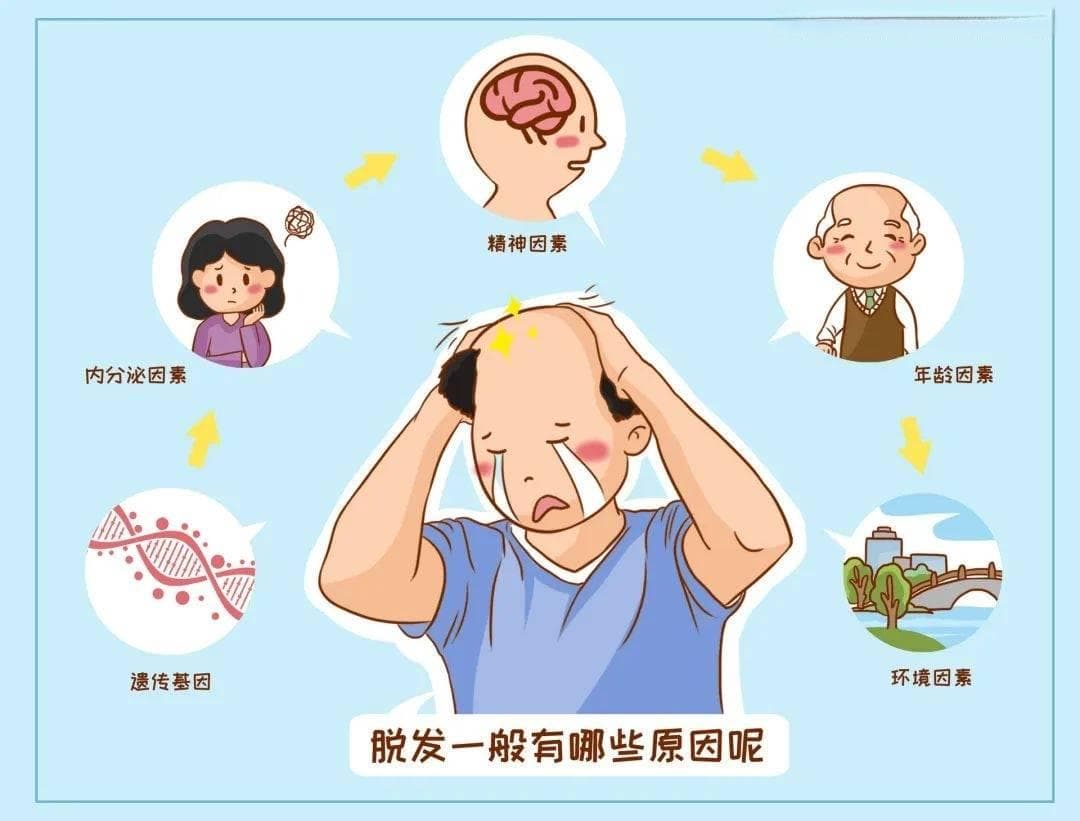 秃顶掉发是什么原因？
