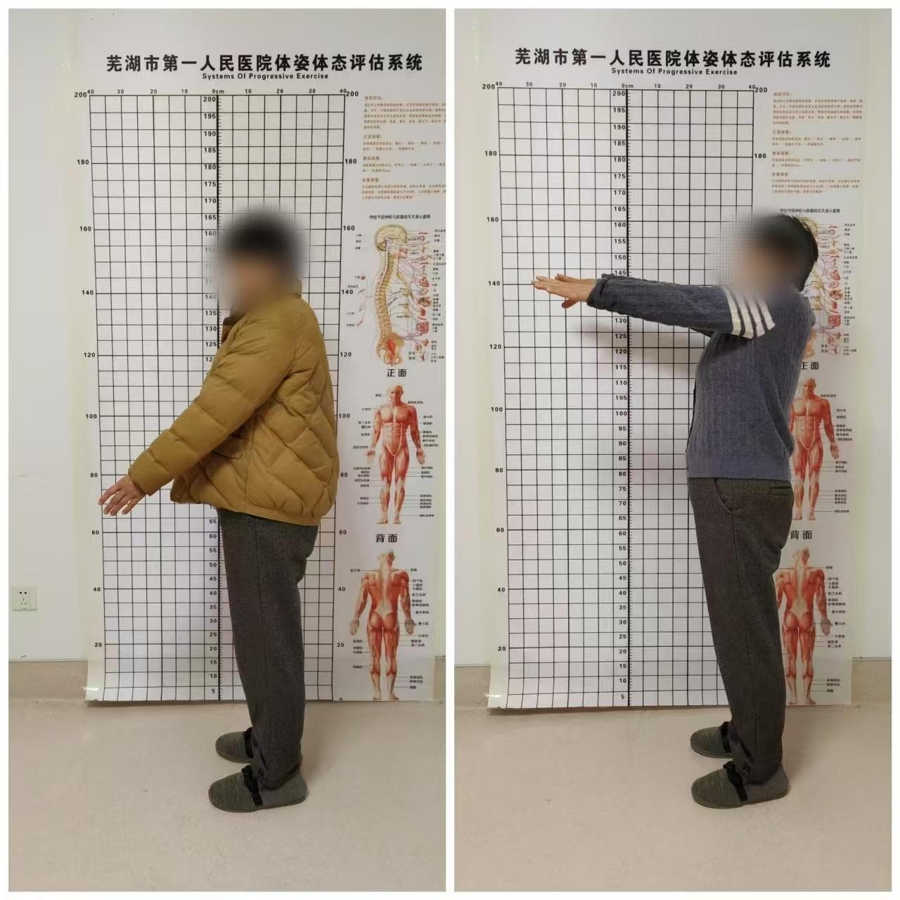 肩袖损伤术后康复，重寻无痛安睡之梦