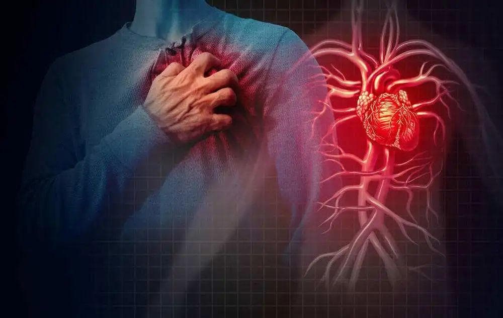 急性心肌梗死早期救治中静脉普通肝素的规范应用与意义