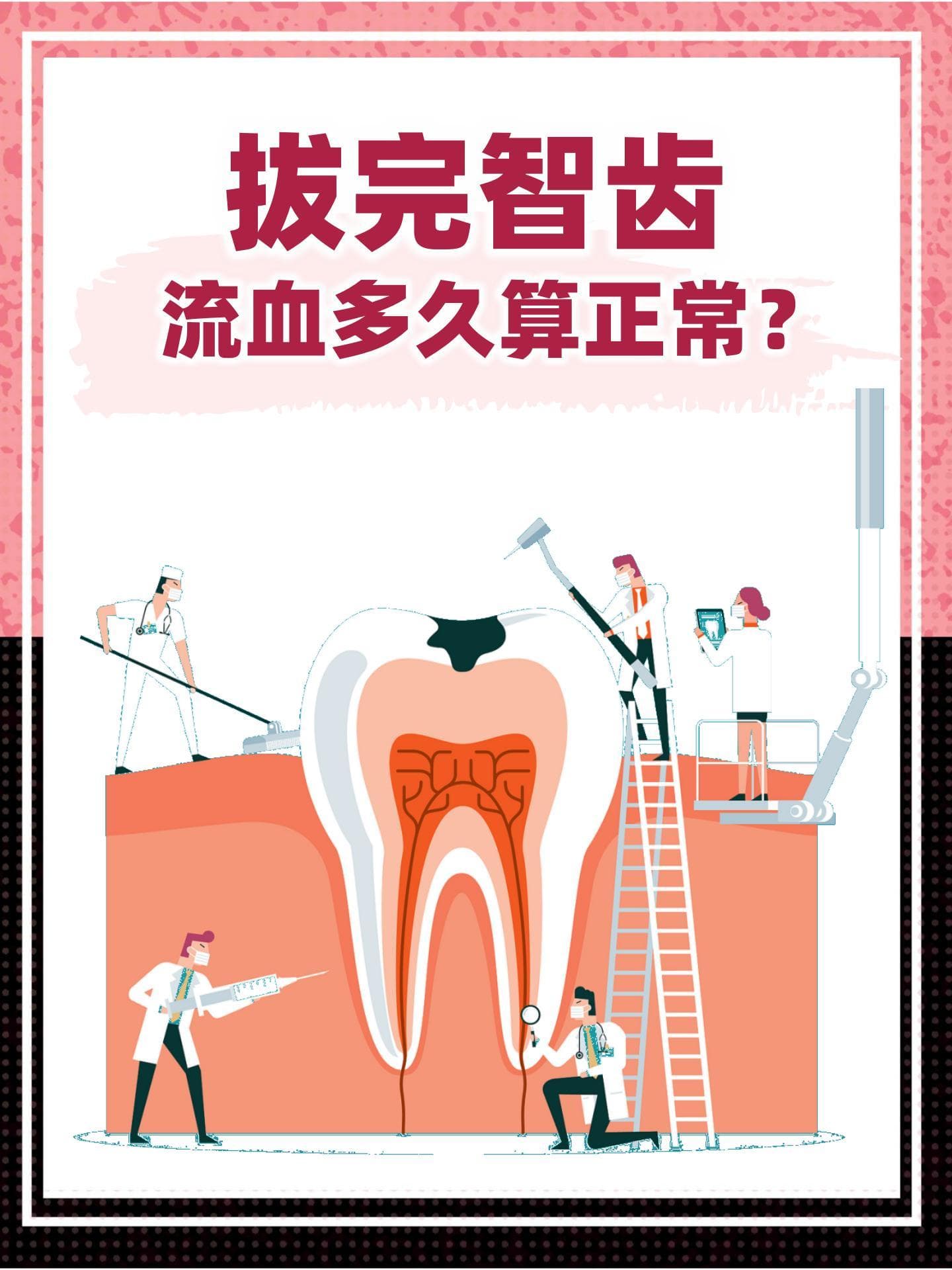 拔完智齿流血多久算正常？