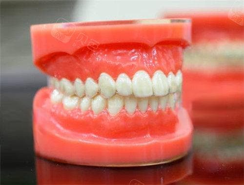 20多岁矫正牙齿，你还在担心什么？正规医生告诉你答案！