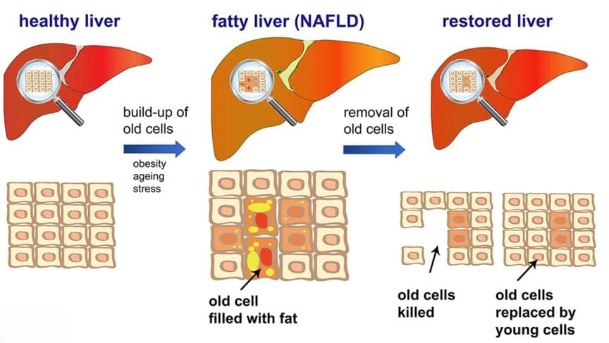 从肝脏健康到理想体重：6种食材的科学选择