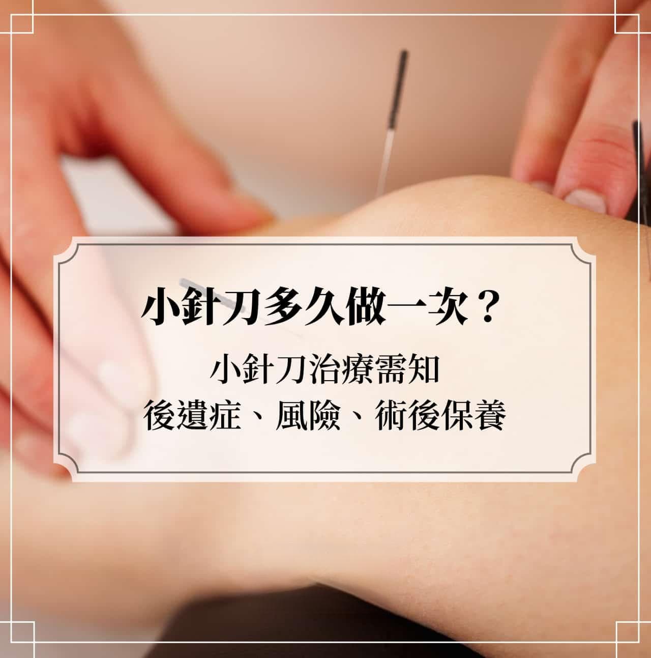 小针刀多久做一次？小针刀治疗需知：后遗症、风险、术后保养
