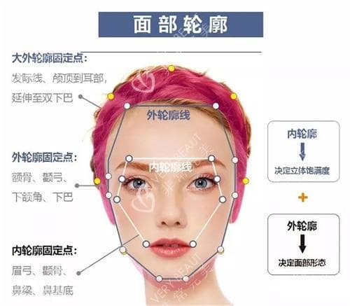 医美达人揭秘：轮廓固定VS轮廓提升，区别究竟在哪里?