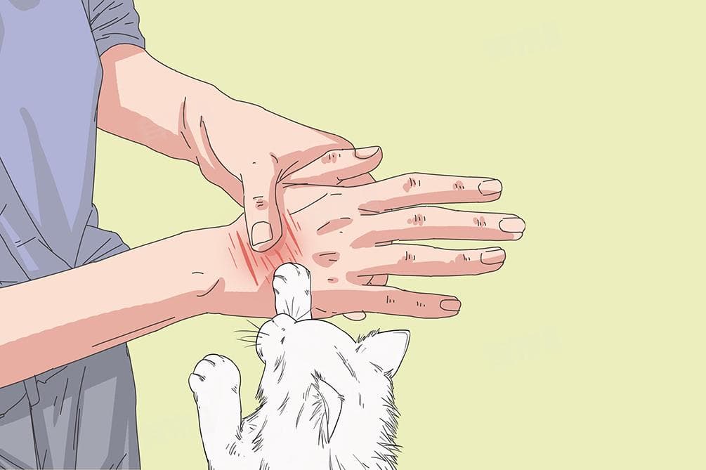 被猫抓伤流血后是否需要打疫苗？一文读懂处理要点