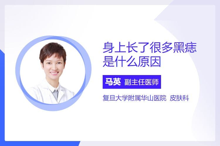 身上长了很多黑痣是什么原因