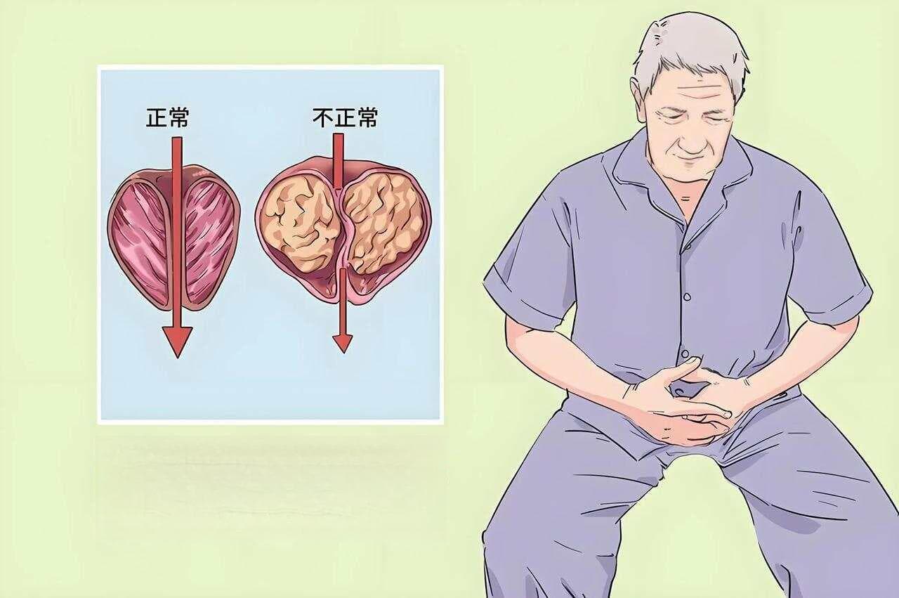 用药探究：治疗中老年人夜尿频多的11个用药方案，多角度标本兼治