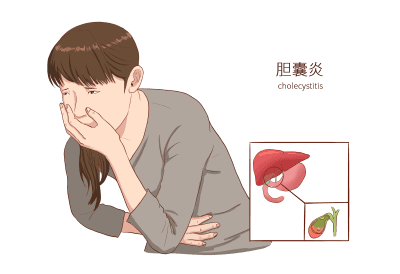 急性胆囊炎来袭如何识别与应对