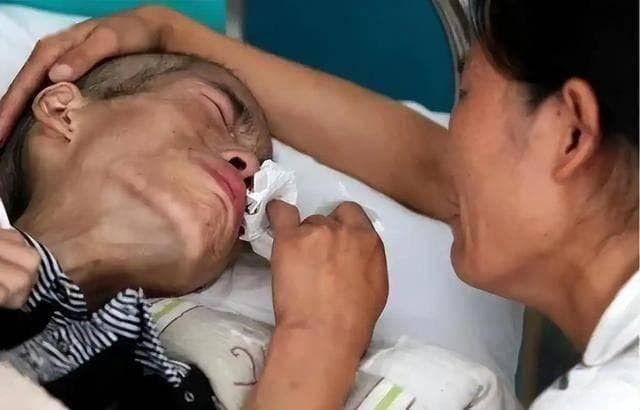 医生提醒：身体这三个部位的"突起"可能是癌症信号，别等到晚期才后悔