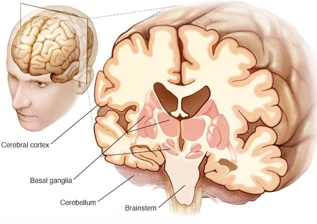 进行性核上性麻痹：症状、病因及治疗