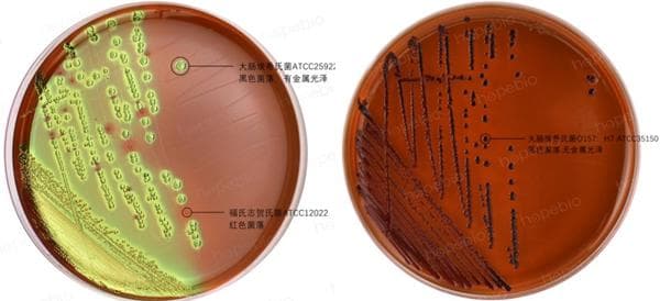 常用大肠杆菌分离和计数培养基的比较分析