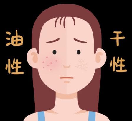 干皮和油皮哪个更缺水？