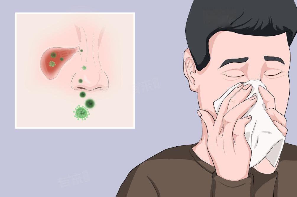 鼻窦炎手术费用详解：影响因素及价格范围