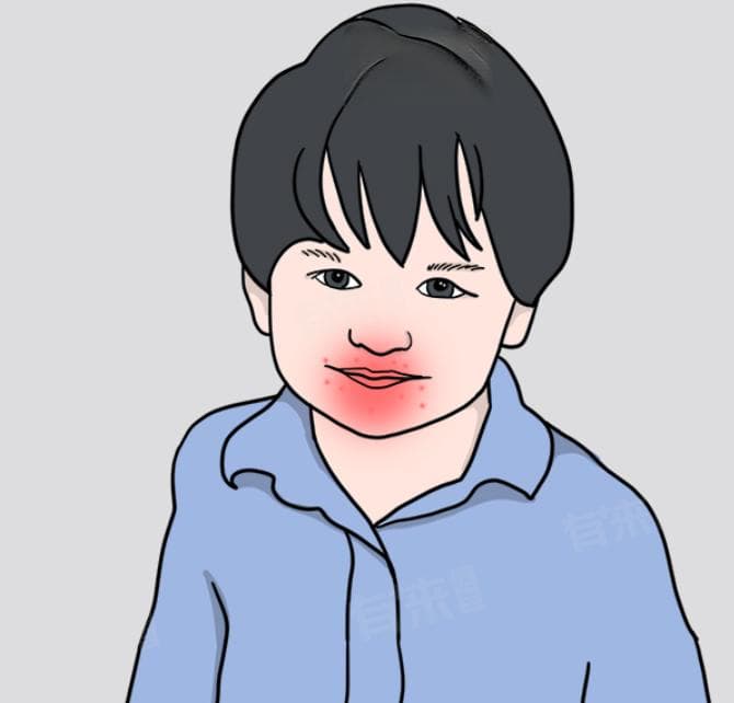 小孩手足口病的最佳治疗方法
