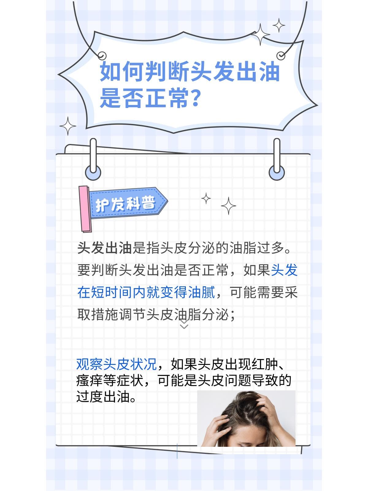头发几天出油才算正常？科学护发有妙招
