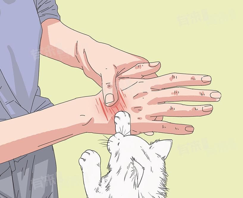 被猫抓伤后的正确处理方法