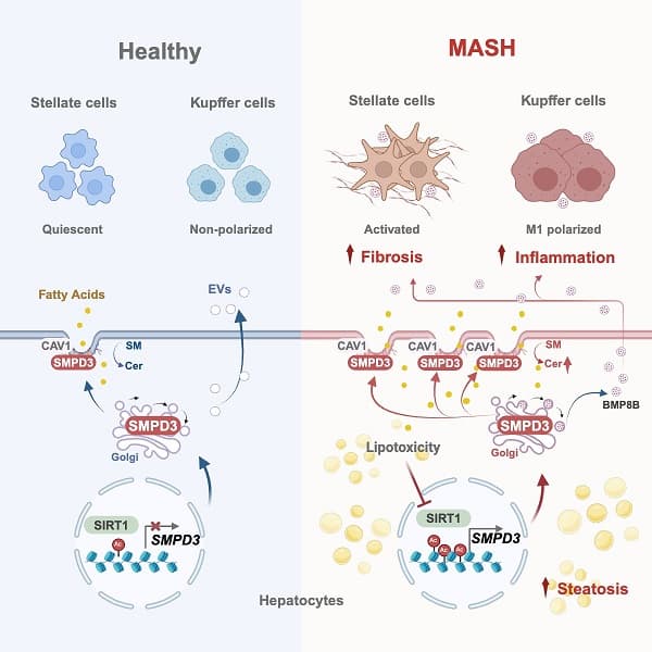 上海药物所合作揭示靶向肝细胞膜鞘脂代谢改善MASH的机制