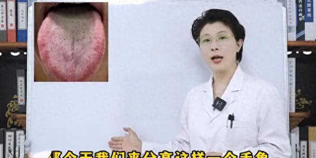 最可怕的不是脾虚，而是肝郁脾虚，别再一个劲的吃参苓白术丸了