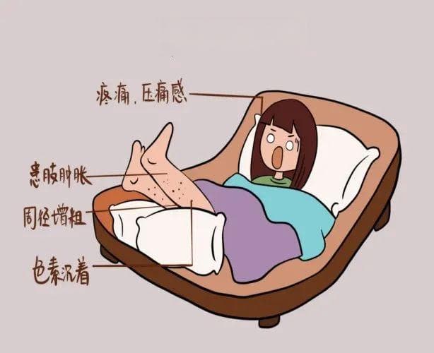 骨科“沉默”的杀手——静脉血栓栓塞症（VTE）