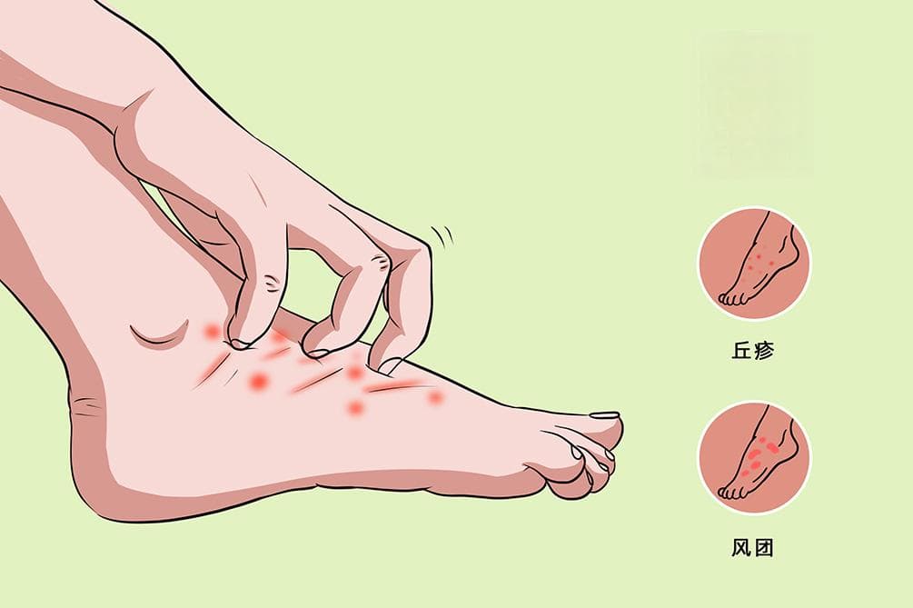 脚背痒越抓越痒什么原因