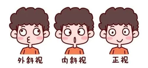 戴上三棱镜后斜视是否“看不出来”？从光学原理到临床应用的全面解析