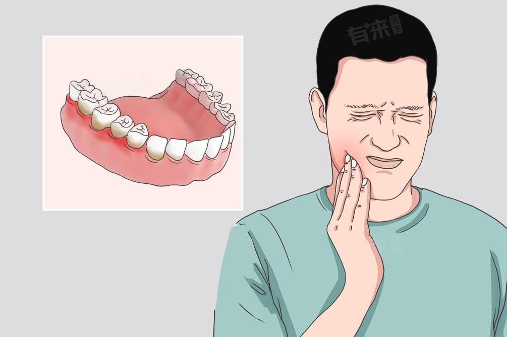 慢性龈炎是什么病，能治愈吗