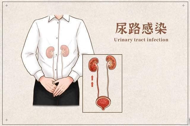 尿路感染知多少？为何我成了“易感人群”？如何治疗与预防?