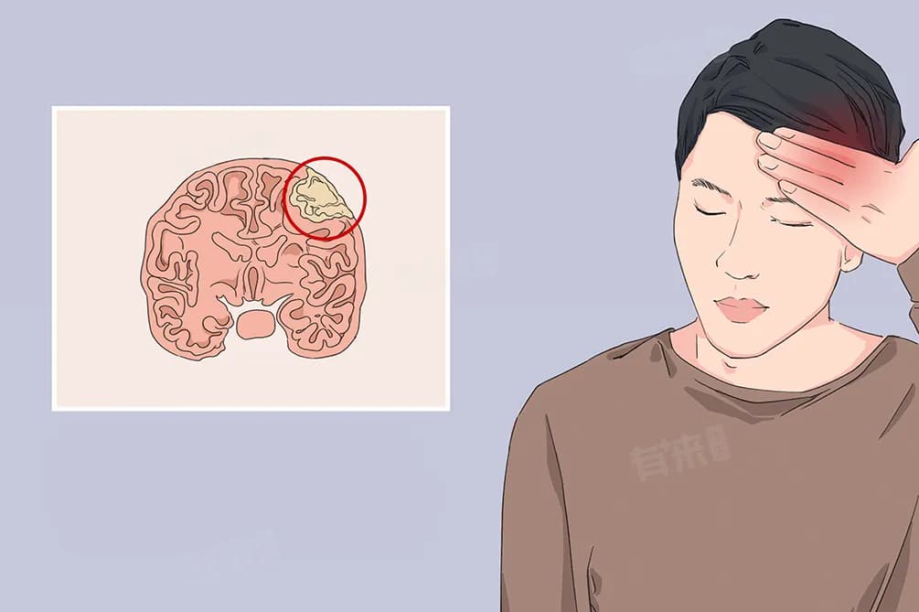 射波刀治疗肿瘤的副作用及危害
