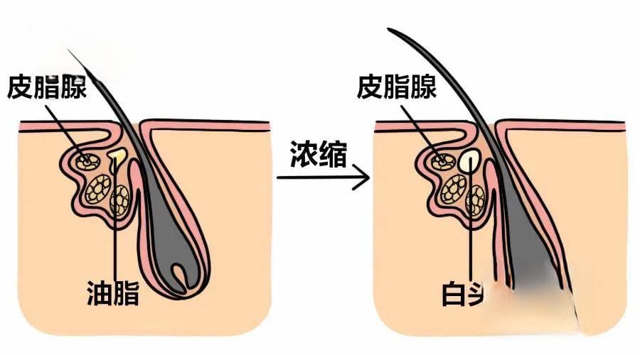 千万别再扣头上的小疙瘩了，当心是这4种病要找上来了
