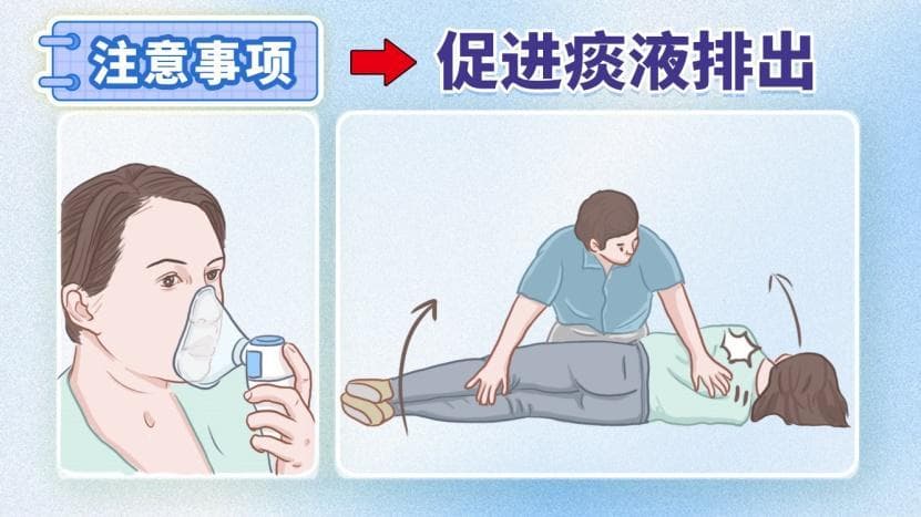 治疗肺气肿——肺减容手术须知！