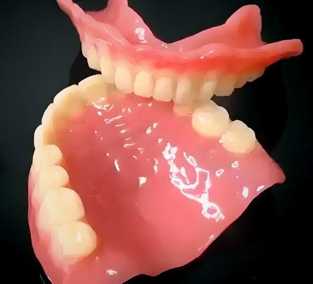 BPS义齿革新：吸附固位加生物设计，提升全口义齿修复效果
