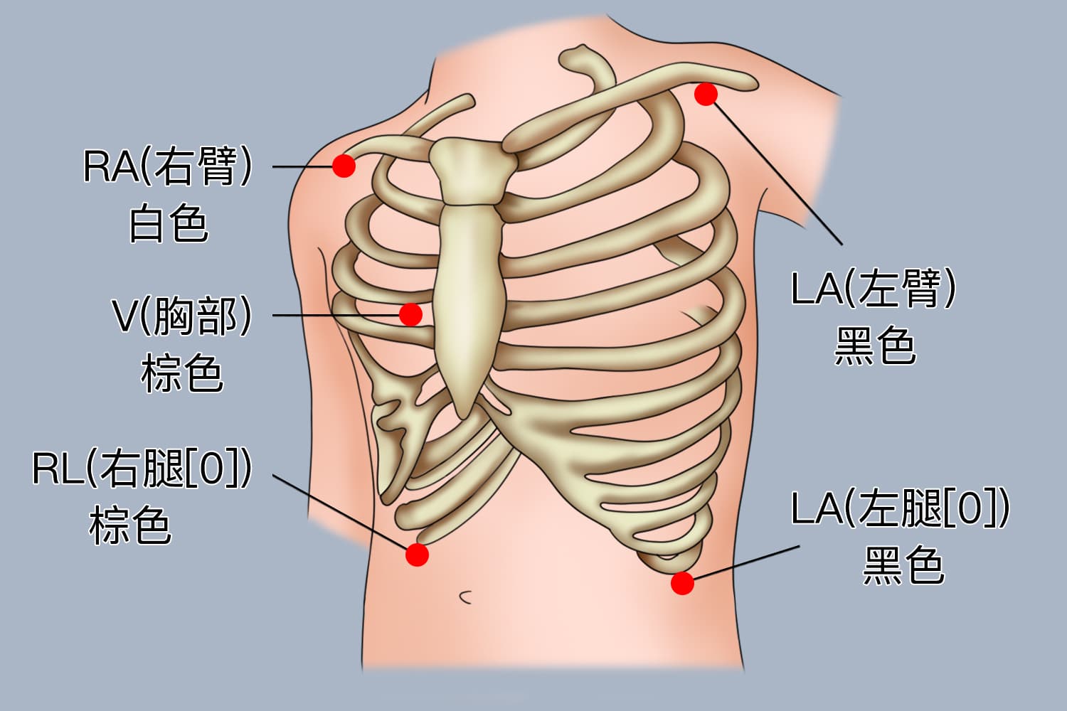 心电电极贴片位置详解：确保心电图监测准确性的关键